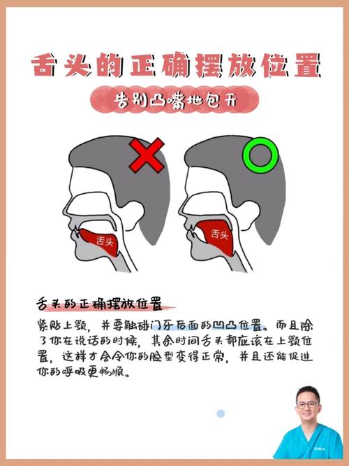 舌头的正确摆放位置73被忽视的细节bug6015_口香糖_整牙_口腔