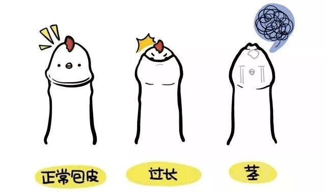 男宝宝家长要注意包皮那点事马虎不得