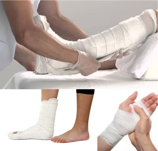 医疗骨科流行绷带石膏巴黎铸造绷带