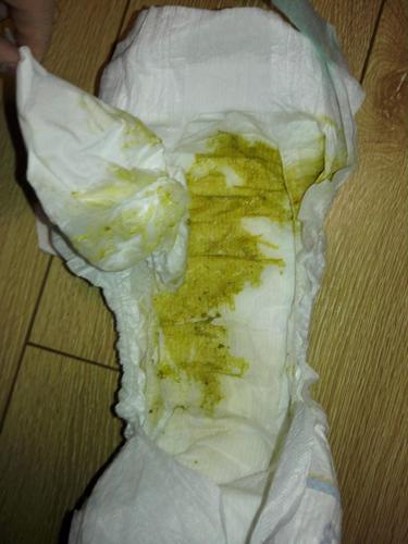 大便之前可能肚子疼,吭吭唧唧的,要求抱.