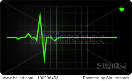 electrocardiogram