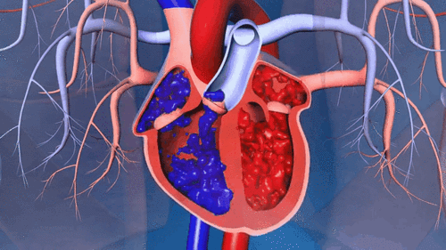 瓣膜会顺着血液的方向打开,可是当静脉血管受堵时,血液无法顺畅的回流