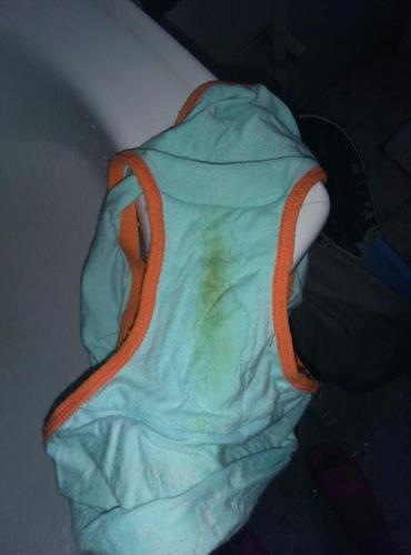 孕妇的白带是这样色正常吗