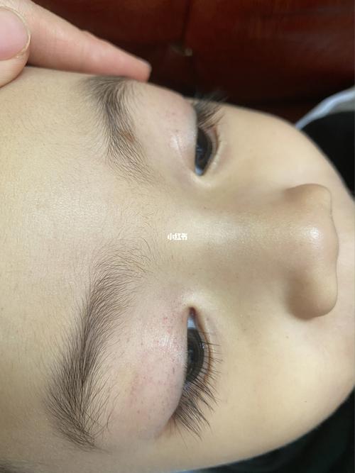 眼睛周围长了好多小红点路过帮忙看看_萌娃_萌娃日常