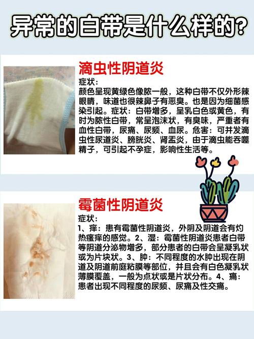 千万不要像我这样_宫颈癌_乳酪_子宫_日常护理_白带异常_医疗健康