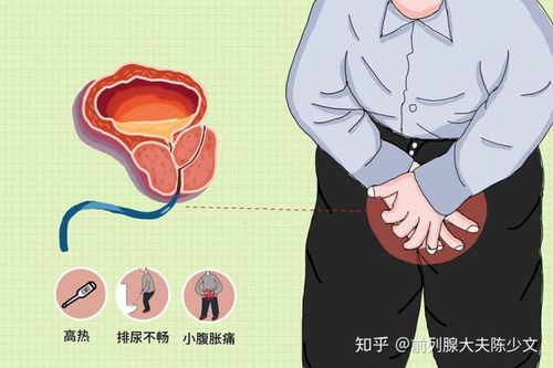 尿频,尿急,尿不尽,尿等待是前列腺炎吗?