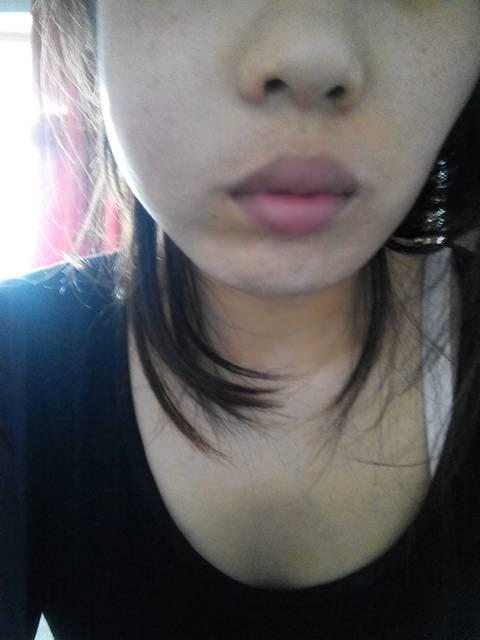 又半个脸因牙齿肿痛脸肿了怎么让脸消肿求方法