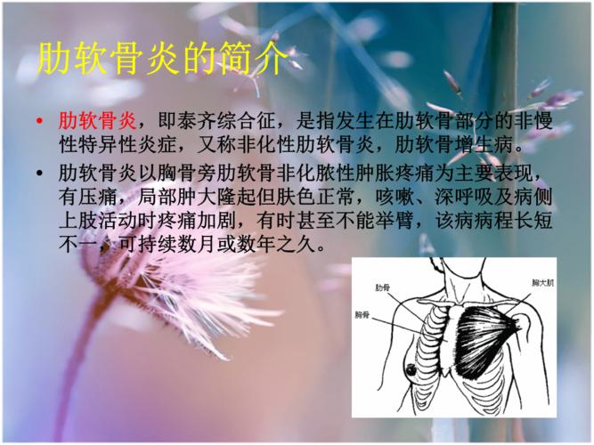 肋软骨炎.ppt
