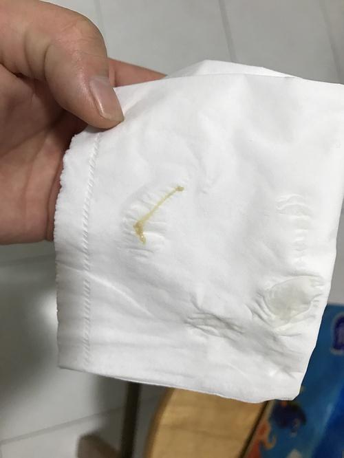 用了茶树精油,白带变成这样