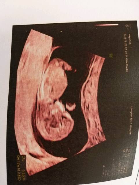 也是分不出男孩女孩的你要好好的去释放自己只要孩子健健康康的就.