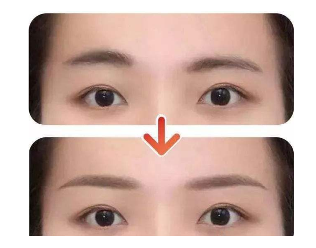 眉毛不一样还有什么不同