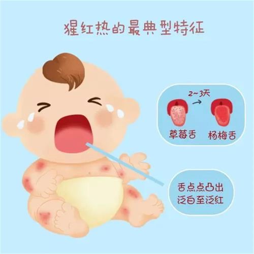 新城双照学区庞村幼儿园"停课不停学"小班组第34期】《猩红热的预防》