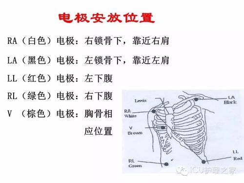 心电监护仪的使用及观察