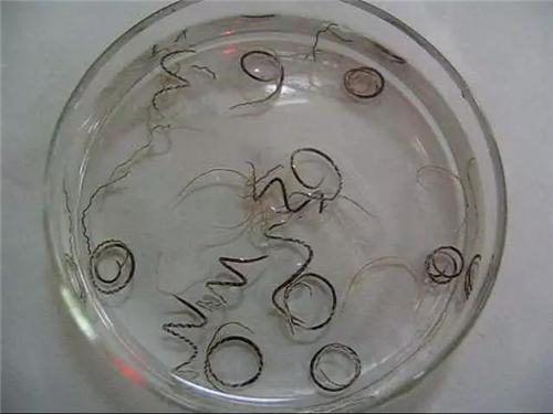 《寻虫环游记》第一站:广州管圆线虫