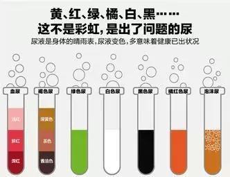 2 血红蛋白尿.   3 肌红蛋白尿.