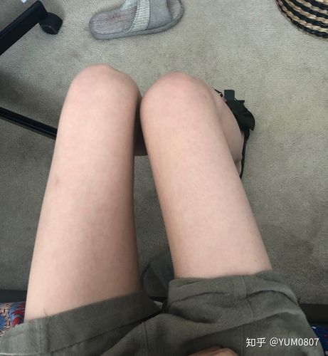 女生腿太细是种怎样的体验