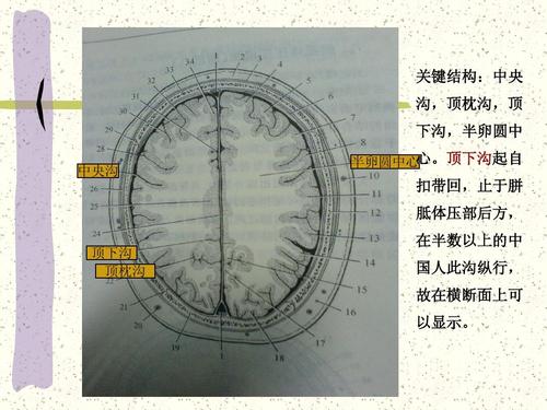 顶下沟起自 半卵圆中心 扣带回,止于胼 胝体压部后方, 顶下沟 顶枕沟