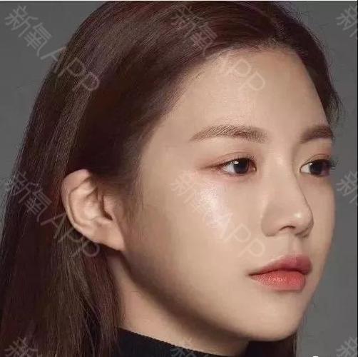 嘴巴没有免俗变成了m型嘴唇 但区别在于她的下嘴唇更厚,更饱满