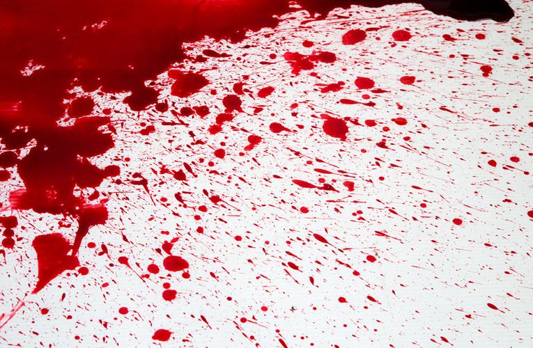 血渍图片下载(图片id:315186)_-其他人物-图片素材