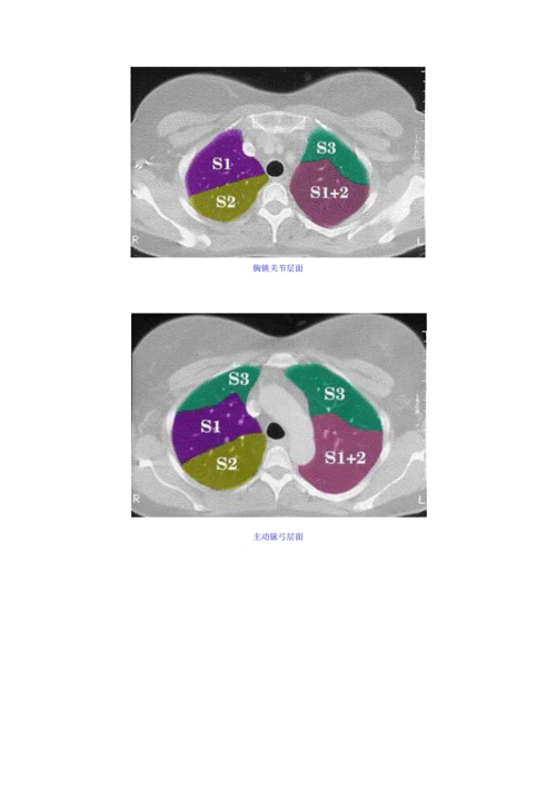 正常肺段的划分.doc