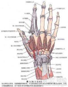 手指关节融合手术是什么意思
