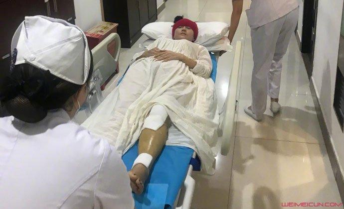 杨丽萍练舞摔倒骨折 送医现场画面曝光小腿伤势惹人疼