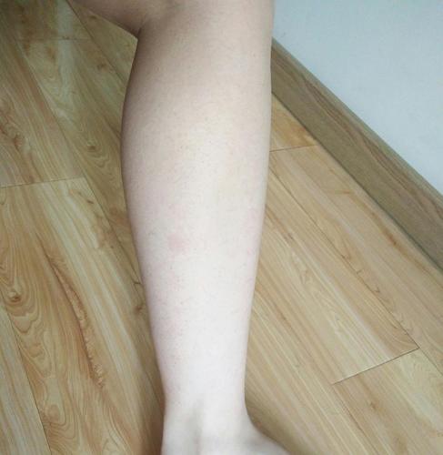 姐妹门怎么瘦小腿啊大腿围50小腿围36流泪了