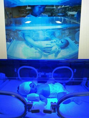 黑龙江省医院儿科新生儿