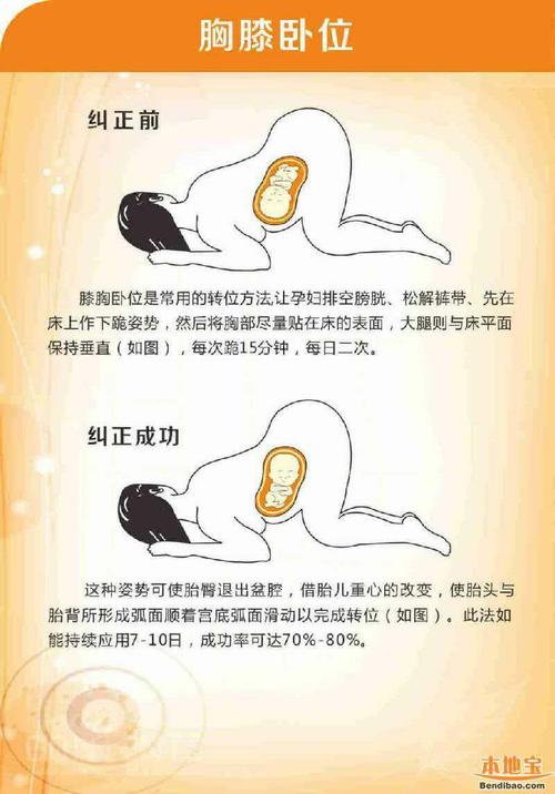 31周胎位臀位,怎么办
