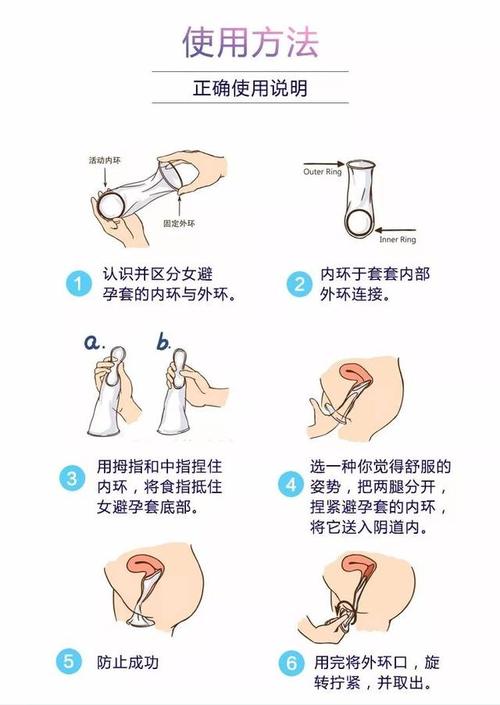 女用避孕套和男用避孕套有什么差别吗?