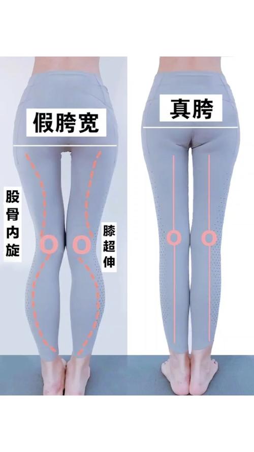 一招矫正xo型腿/假胯宽,让腿变细变直!_整形_医美_美妆_医美整形