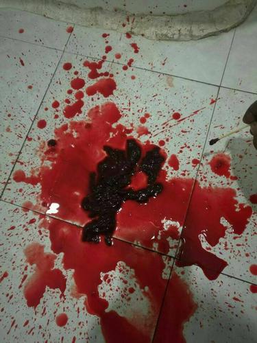 请大家帮我解答,老婆八月十八号做的清宫手术,说是葡萄胎,九月十五号