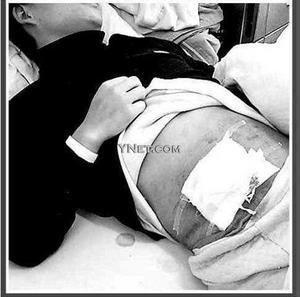 要到境外渔船打工 必须割掉阑尾?(图)