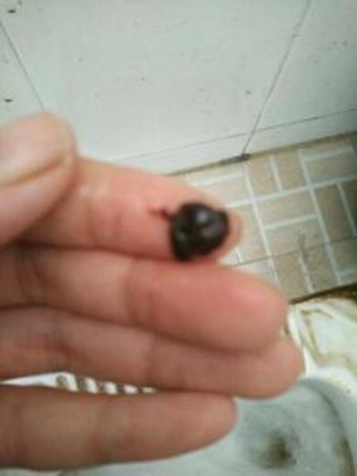 早孕药流排出的孕囊形状图片