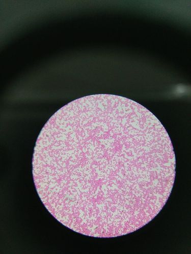 血细胞当中的红细胞:在显微镜下看起来像一个个小点,红色的红细胞能够