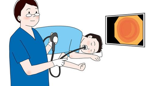 全球超四成新发胃癌患者在中国,胃镜到底从多少岁开始做