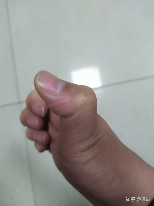 为什么大拇指根部关节可以动?