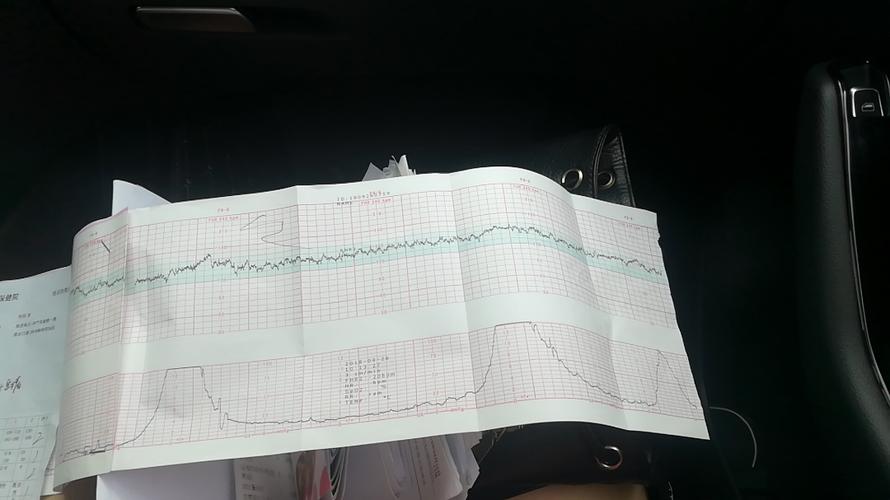 394医生说有规律宫缩了但是胎监很好今天要不要住院