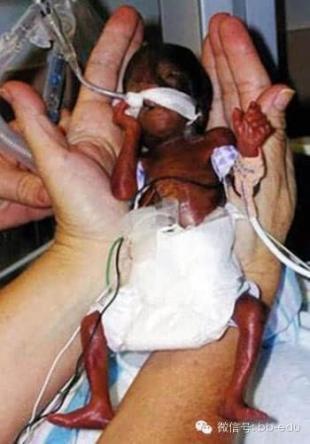 22周胎儿的真实样貌 只有感动!