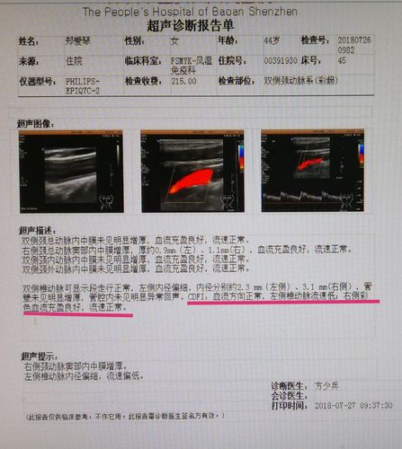 7月26日颈动脉系彩超提示椎动脉血流方向正常,与推断不吻合,必要时