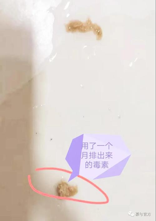 慕兮卡波姆妇科凝胶副作用大吗,哪些人群可以使用,具体有哪些功效