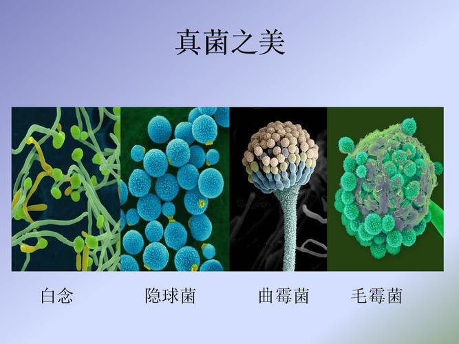 常见抗真菌药物的特点-牟向东.ppt