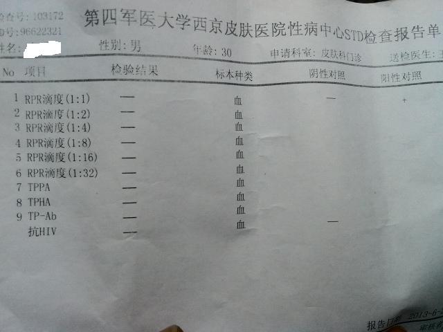 分析如下: tppa和tpha都首ḿ野镂铱纯次业恼庹舎iv化验单看看有问题没