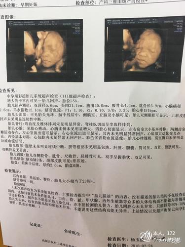 孕17周 0天,宝宝估重679g啦!