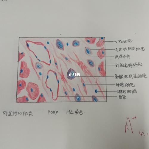 病理红蓝铅笔绘图