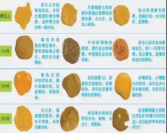 奶瓣,绿便,腹泻,便秘.宝宝的各种便便问题,答案都在