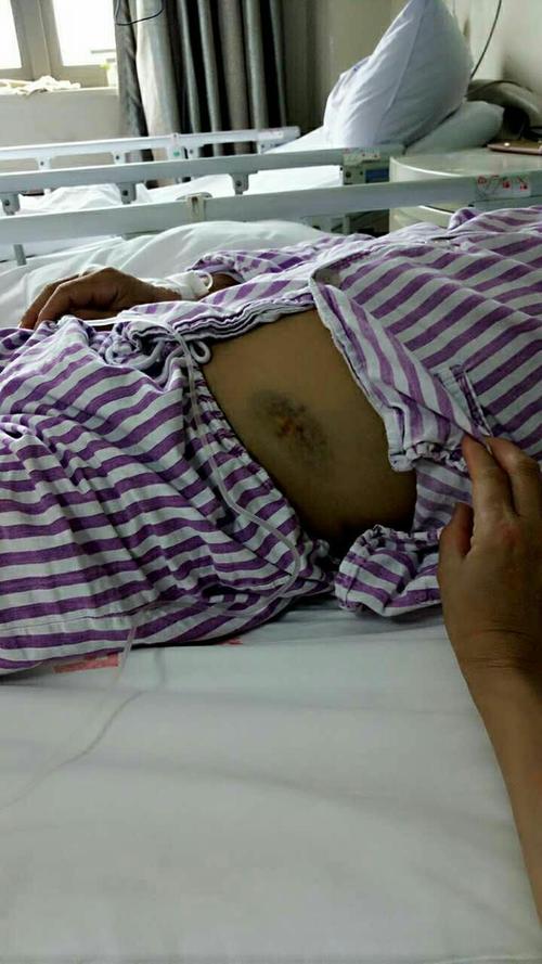 2016年5月16,我老公在新附一新医院检查出来,患上白血病,后来24号这天