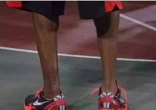 科比跟腱伤疤达30cm,皮尔斯被