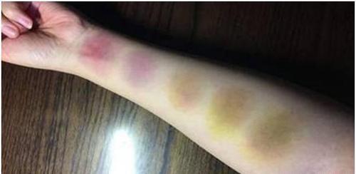 为为什么说人死后不能摸尸体的脸?验尸官告诉你不是迷信而是科学