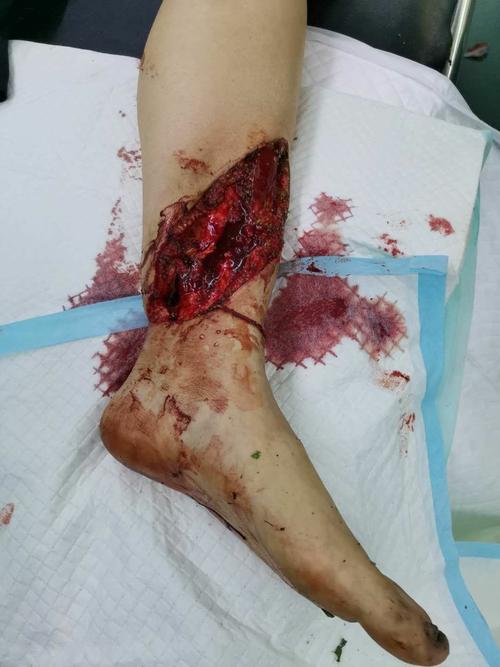 急诊创伤我们在行动